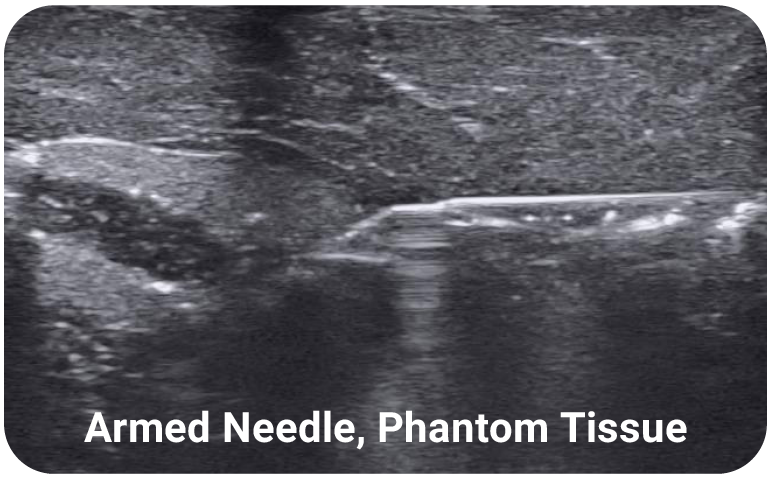 ultrasound image of armed AutoCore™ needle in phantom tissue